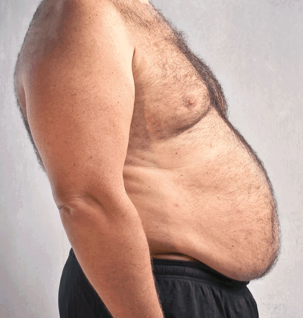 Before After weight loss