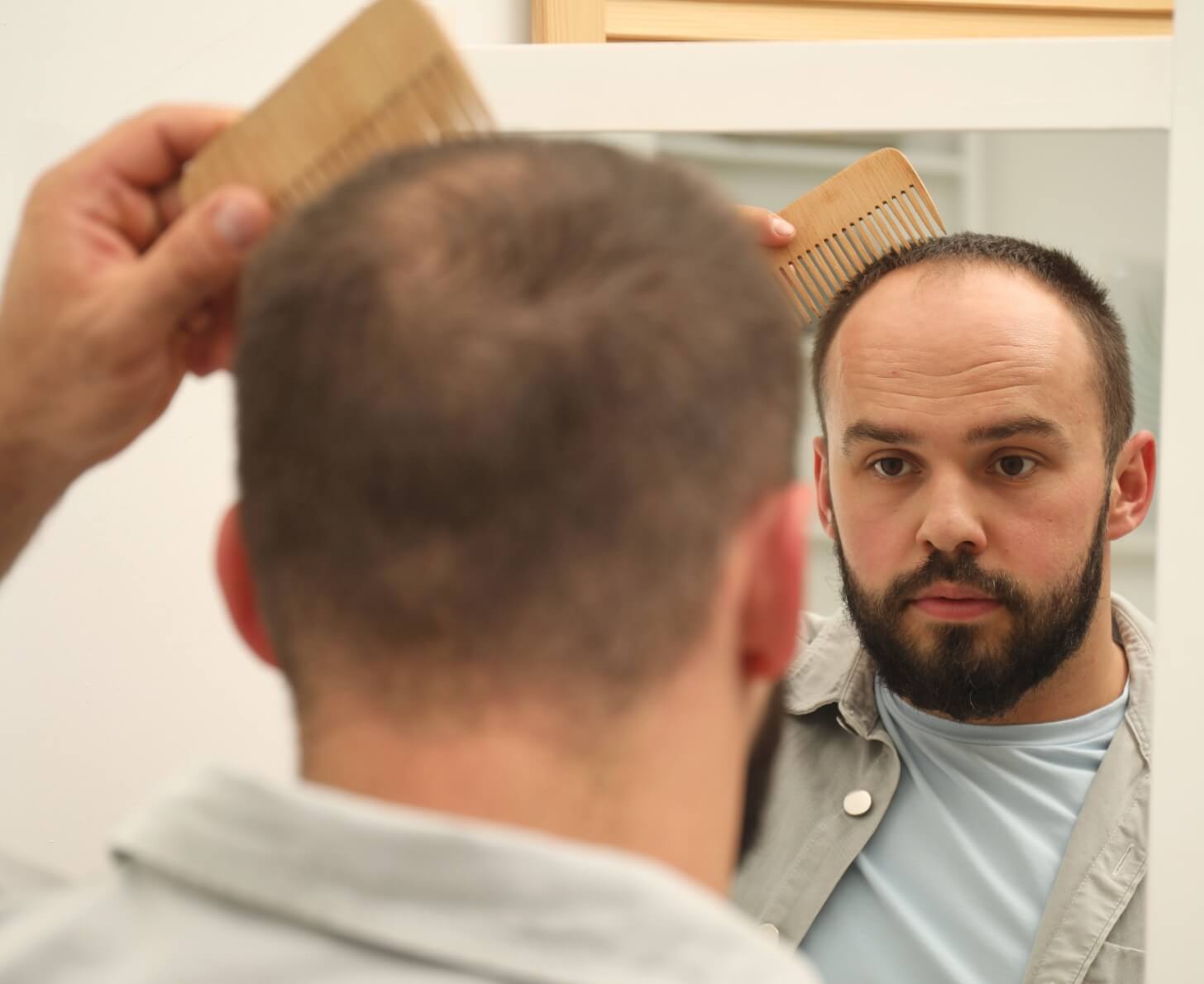 baldness-problem-man-brushing-his-hair-with-comb-2025-12-01-22-22-47-utc (1)